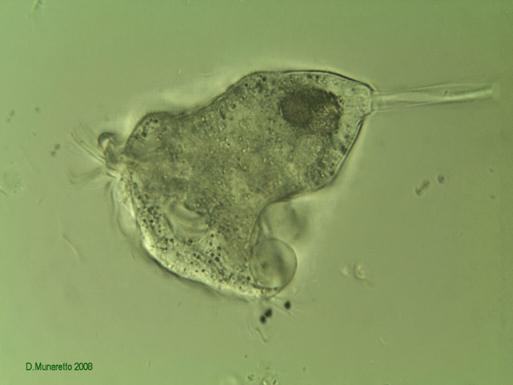 Rieccomi...con Vorticella Gigante a 400x !